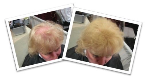 Light Blonde Hair Before & After