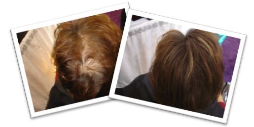 Medium Brown Hair Before & After